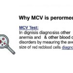MCV Blood Test